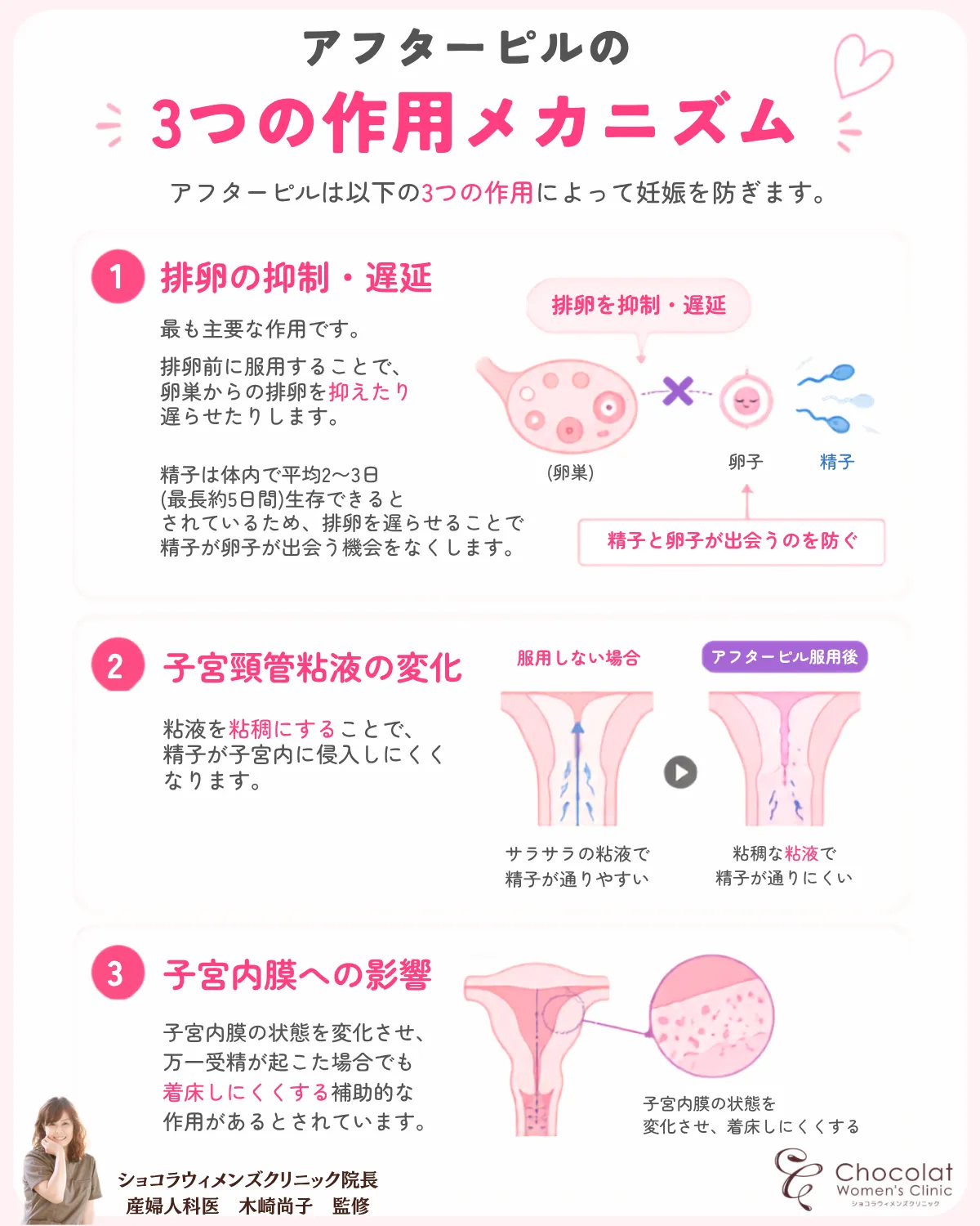 アフターピル　いつまで　3つの作用 解説画像　ショコラウィメンズクリニック